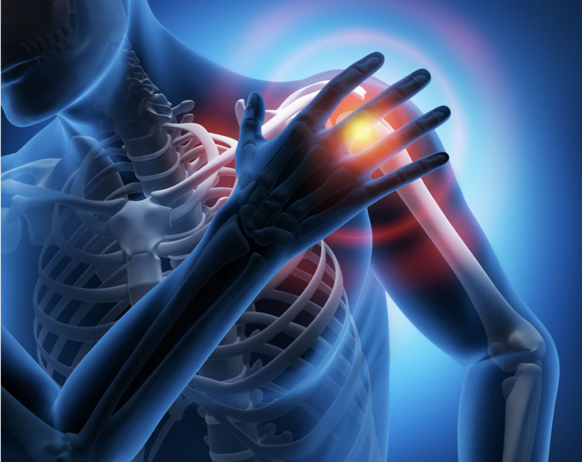 ロキソニン が 効か ない 肩 の 痛み