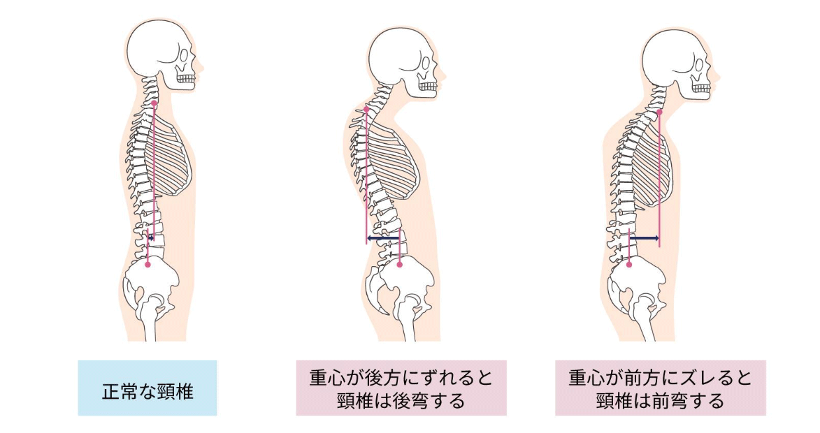 頸椎のイラスト
