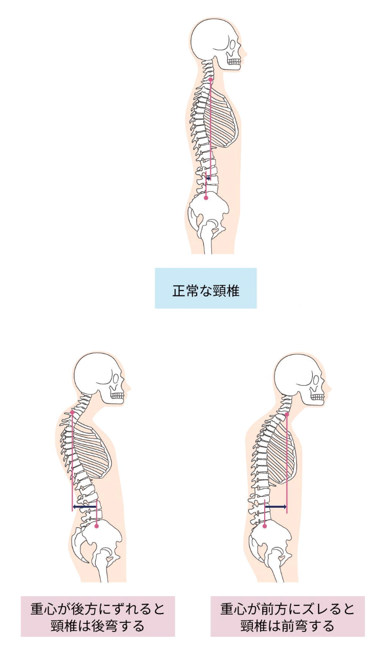 頸椎のイラスト