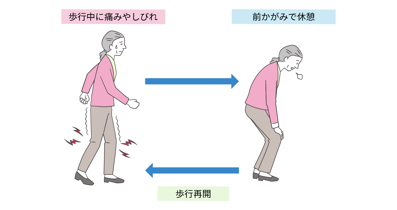 歩行障害のイラスト