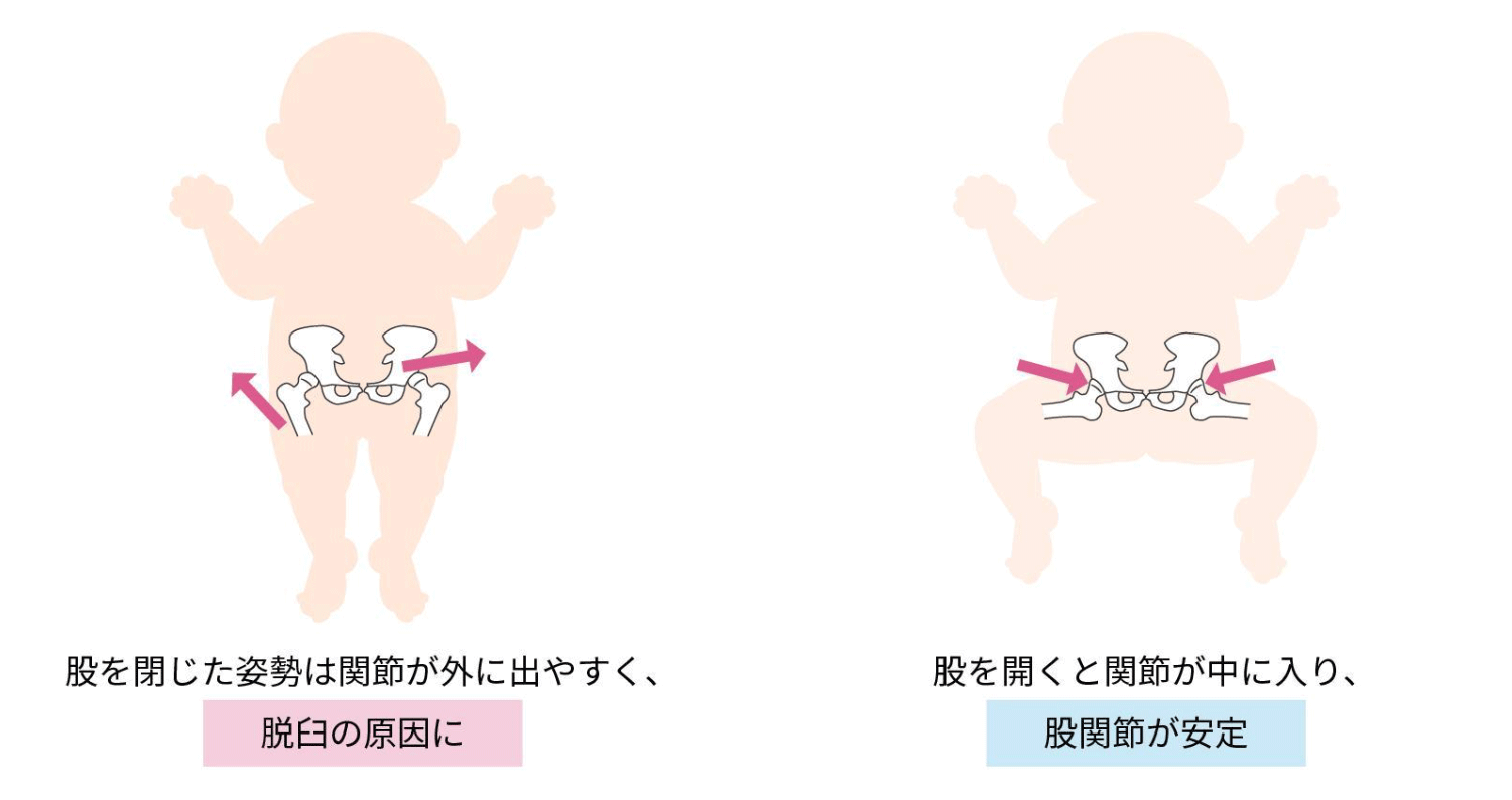 変形性股関節症の原因